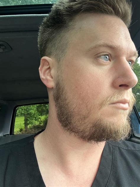 34 Yo Blonde Patchy Can I Pull Off More Bulk For The Winter 1 Month Update Into Winter Beard