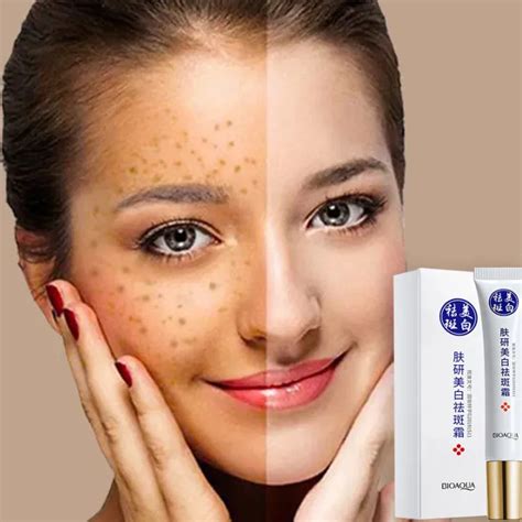 Support CODBuy 2 Get 1 Whitening Freckle Dark Spot Remover Melasma