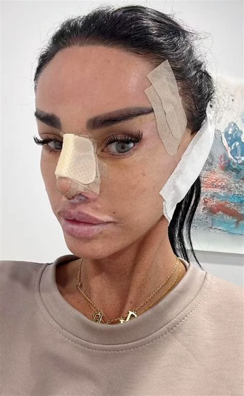 Cựu bom sex bỏ soi gương sau khi mặt biến dạng vì thẩm mỹ quá đà