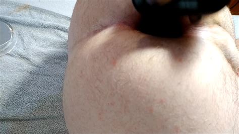 Anal Fun Video 7 ThisVid