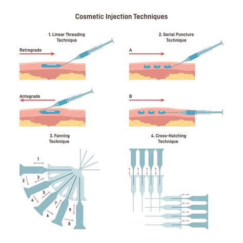 Premium Vector | Cosmetic injection technique set filler hyaluronic