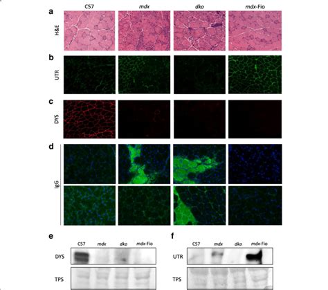 Muscle Architecture And Dystrophin And Utrophin Expression In Extensor