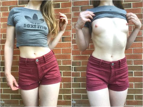 In Need Of Some Vitamin D Got Any To Spare Porn Pic