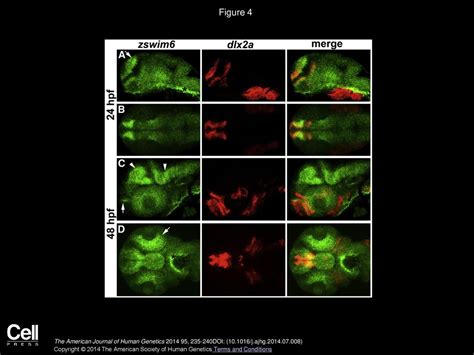 Exome Sequencing Identifies A Recurrent De Novo Zswim Mutation