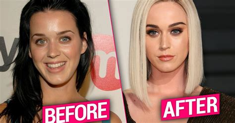 Katy Perrys Plastic Surgery Lies Stars Had Work Done Top Docs Say