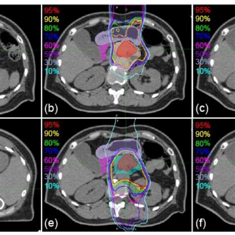 Sample Axial Images Of Supine And Prone Positions With The Dose