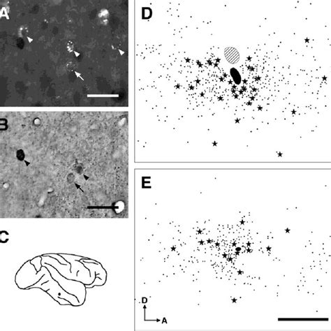 Photomicrographs And Distribution Of The Latex Microsphere Bead