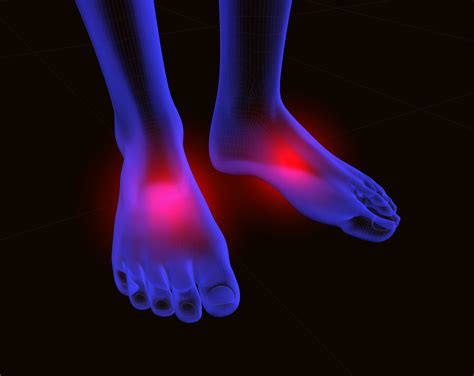 Neuropathy & Neuroma Treatment | Westfield, IN Podiatrist David