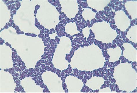 Gram Staining: Principle, Procedure, Results • Microbe Online