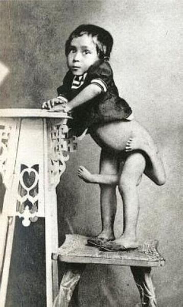 Circus Freaks From Back Then 25 Pics