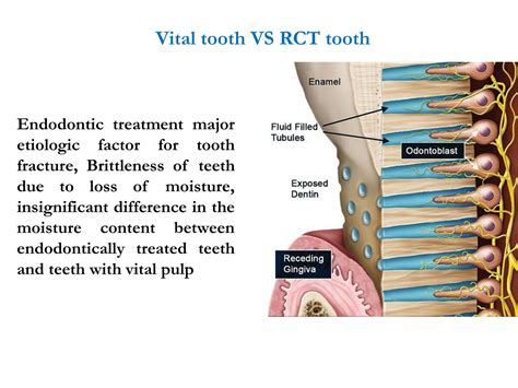 Solution Access Cavity Preparation Studypool