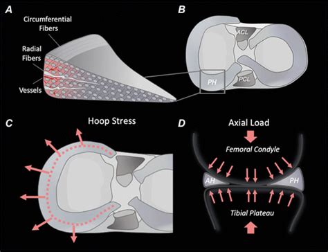 Knee Mri Meniscus Roots Ramps Repairs And Repercussions Radiographics