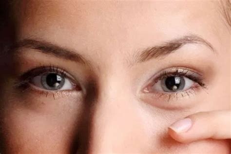 Cholesterol Deposits Around Eyes Home Remedies For Reducing