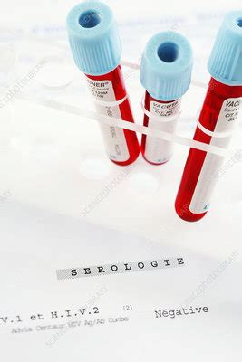 Negative Hiv Test Stock Image C Science Photo Library