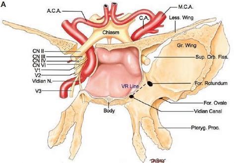 [diagram] Diagram Of Sphenoid Sinuses Mydiagram Online