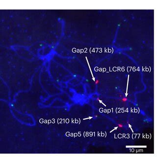 Genome Structure Of S And S Rdna Arrays A Sequence Structure Of A