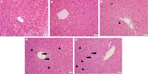 Injury Effect Of Pfoa On Progeny Female Mice A The Control Group B