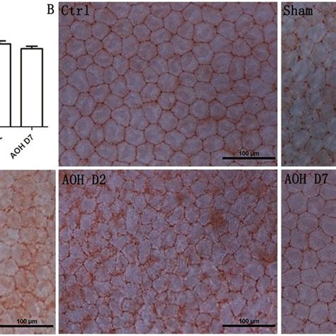 Peripheral CEC density quantification and histology. AOH decreased the... | Download Scientific ...