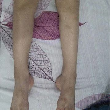 extremities   patient  scientific diagram
