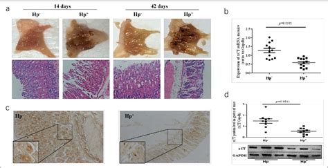 Figure 1 From Role Of The Outer Inflammatory Protein A Cystine