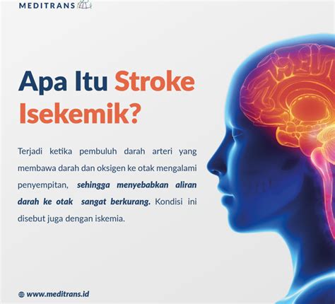 Apa Itu Stroke Iskemik Meditrans Global