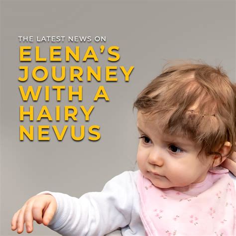 Little Baby Face Foundation | Facial Birth Deformity Corrections