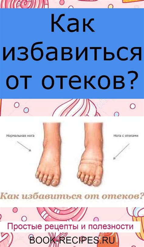 Как снять отечность ног и избавиться от отеков в домашних условиях