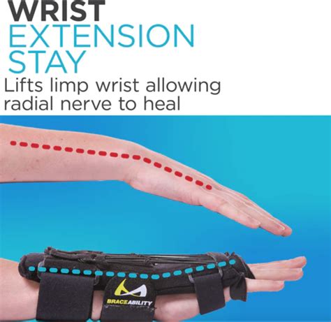 Pisces Healthcare Solutions Radial Nerve Palsy Splint Dynamic Wrist