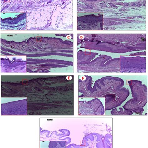 Hematoxylin And Eosin Stained Sections Of Mice Vagina Light