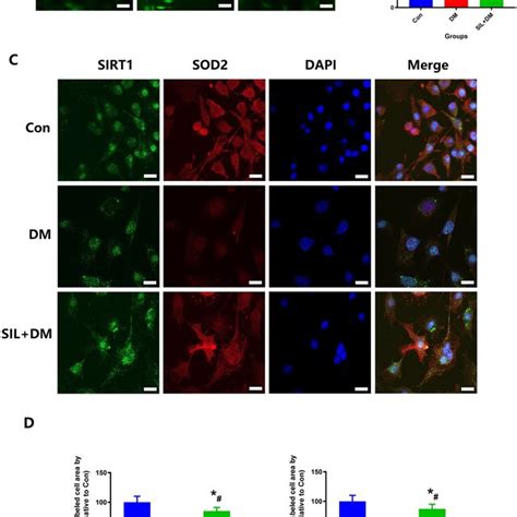 SIL Therapy Could Reduce ROS Levels And SIRT1 And SOD2 Expression In