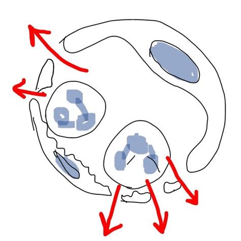 Inflammation Part General Concepts Types Vascular Changes In Acute