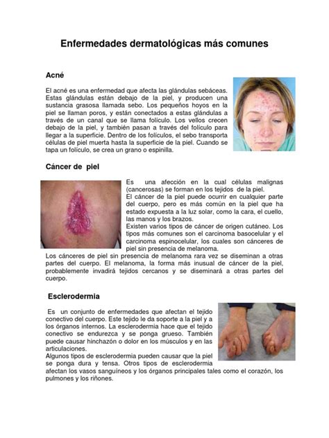 Enfermedades Dermatológicas Más Comunes | PDF | Piel | Cáncer