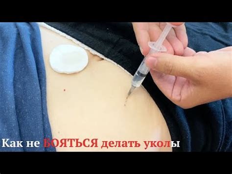 Как не бояться делать уколы дома! Как делать укол в домашних условиях ...