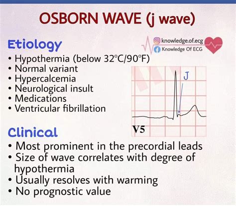 Sthanu on Twitter: "Osborn Waves deflection with a dome or hump configuration occurring at the R ...