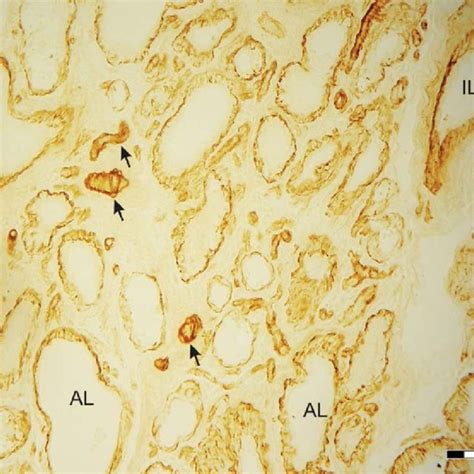 Immunostaining For SMA The Myoepithelial Cells Form A Complete Layer