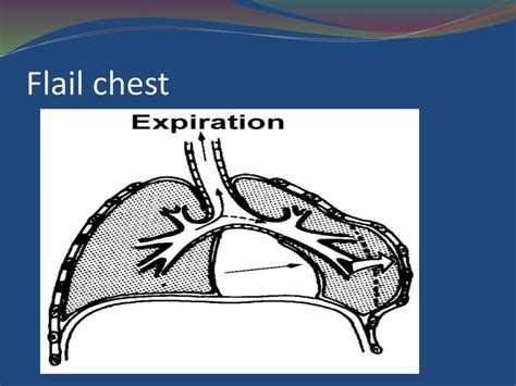 Physical Signs Of The Thorax Ppt Download