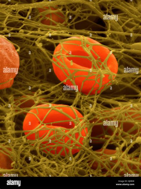 fibrin clot sem  res stock photography  images alamy