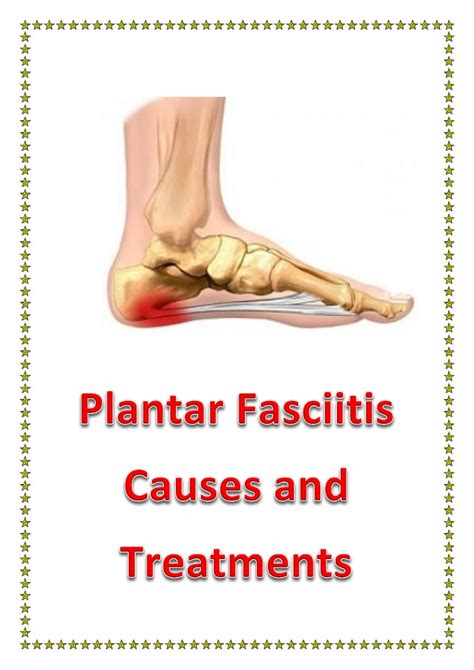 Plantar fasciitis causes and treatments
