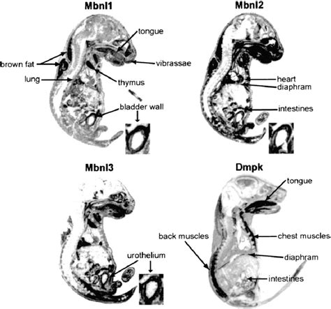 In Situ Hybridization Analysis Of Late Stage Embryos Reveals Expression Download Scientific