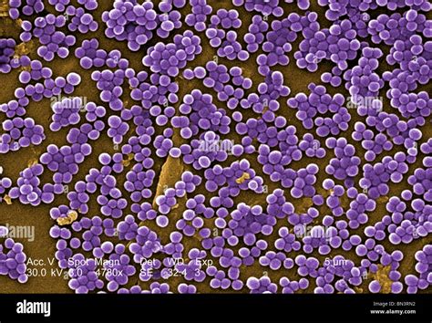 Scanning Electron Micrograph SEM Of Methicillin Resistant