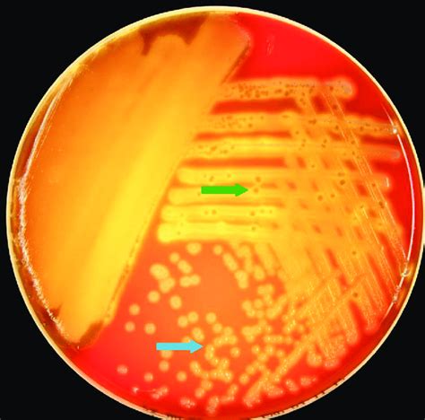 Mixed Culture Of Streptococcus Pneumoniae And Listeria Monocytogenes On