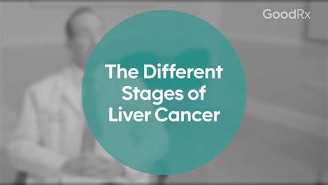 What Are The Different Stages Of Liver Cancer Goodrx