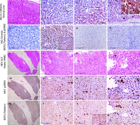 Representative Images Showing Immunohistochemical Expression Of Bst