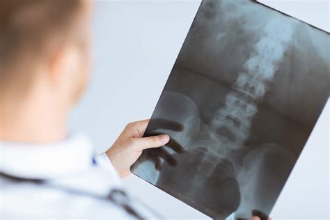 Spinal Lesions: Symptoms, Causes, Diagnosis, and Treatment