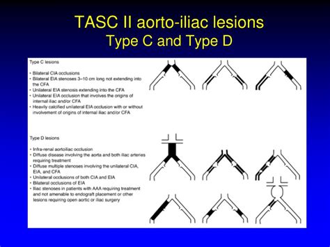 Ppt Is There Still A Controversy About Stent Type For Tasc C D