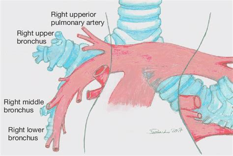 Pulmonary Artery Diagram