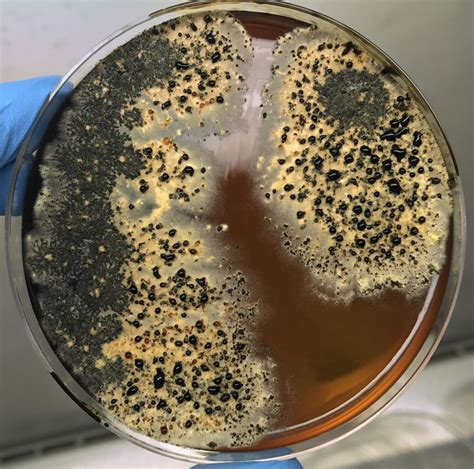 Viable Culturing Fungi Mould Bacteria