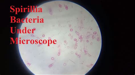 Viewing Spirilla Bacteria Under Compound Microscope Biology Demonstration Youtube