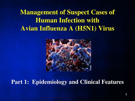 PPT Management Of Suspect Cases Of Human Infection With Avian