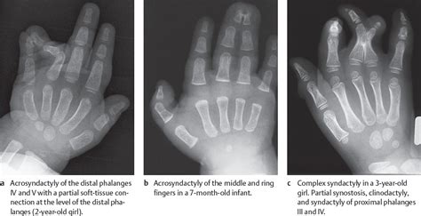 16 Malformations And Deformities Radiology Key